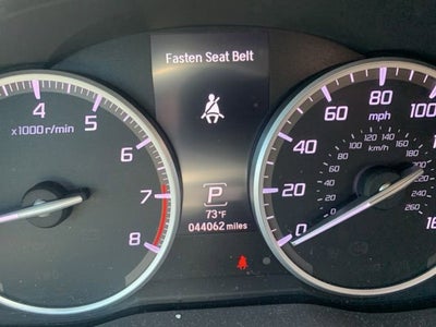 2017 Acura RDX AWD w/Advance Pkg